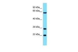 FAM220A Rabbit anti-Human, Polyclonal, Novus Biologicals 0.1ml; Unconjugated:Antibodies,